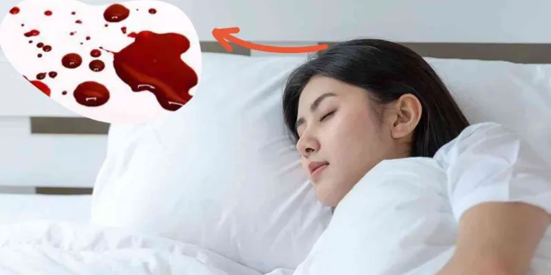  Ý nghĩa những trường hợp mơ thấy máu chảy 